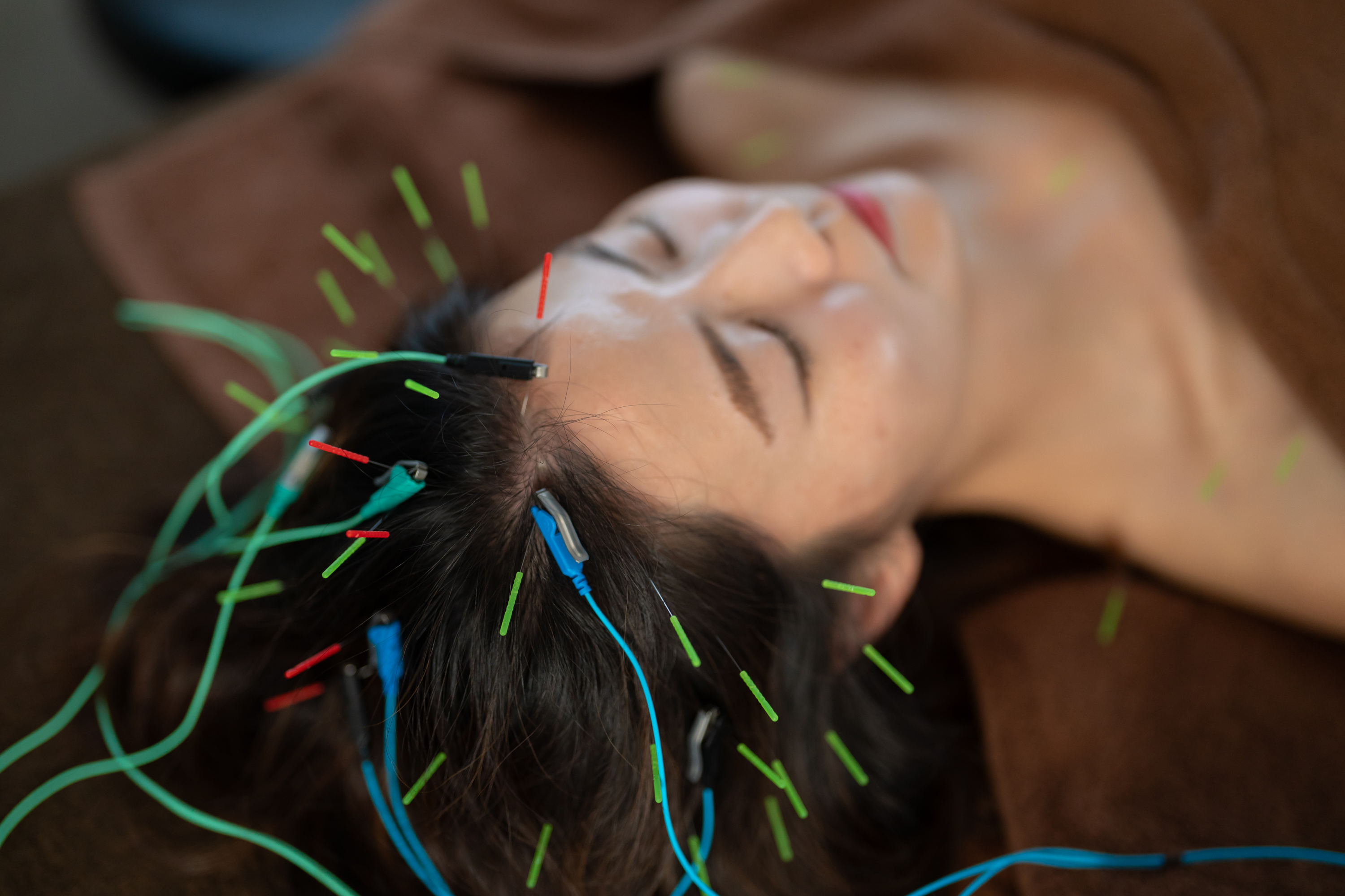 reCare道玄坂鍼灸院 ハリミン【睡眠の質改善　不眠解消】のメニュー画像