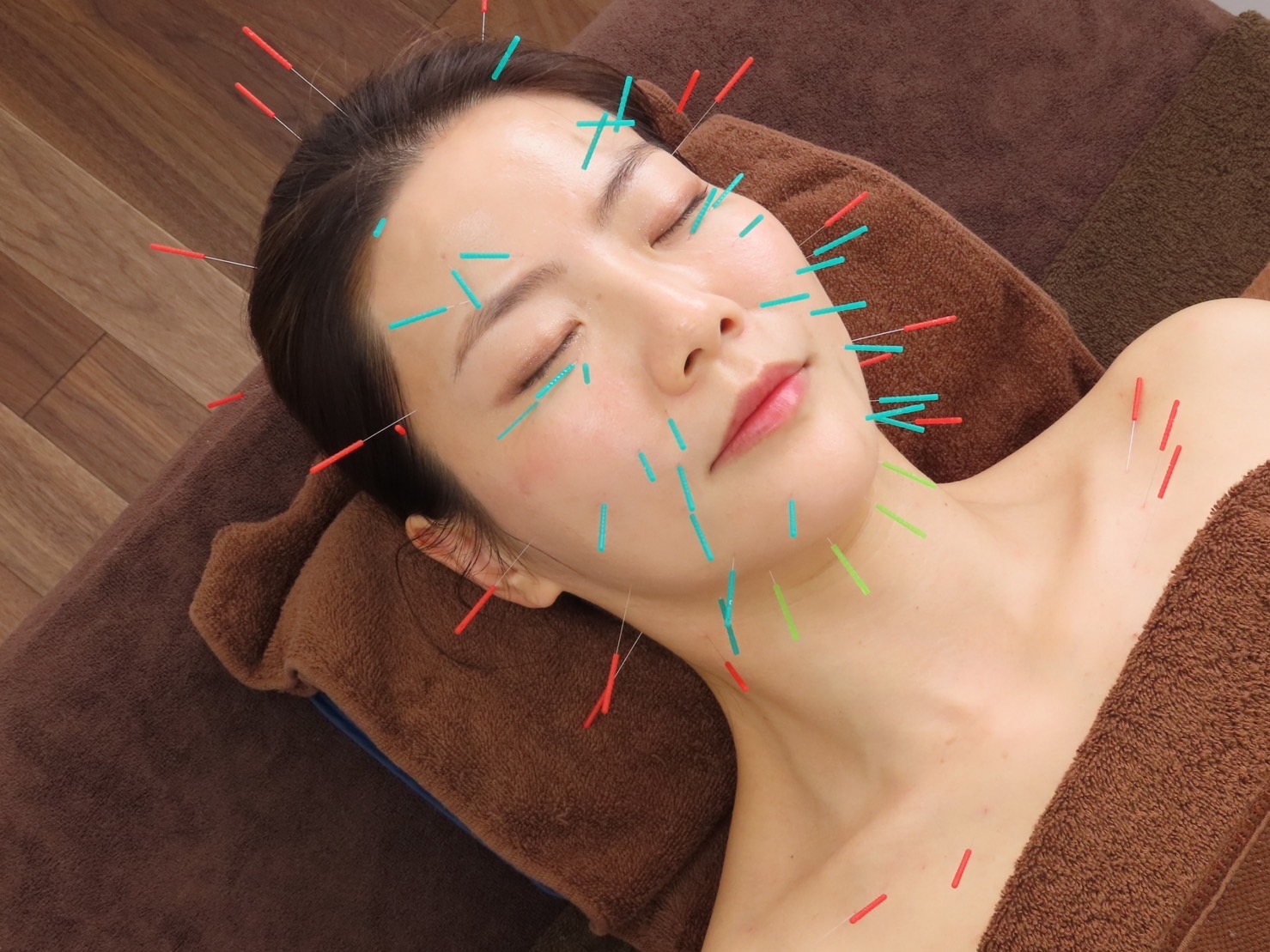reCare道玄坂鍼灸院 美顔鍼コース （お顔のみ）のメニュー画像