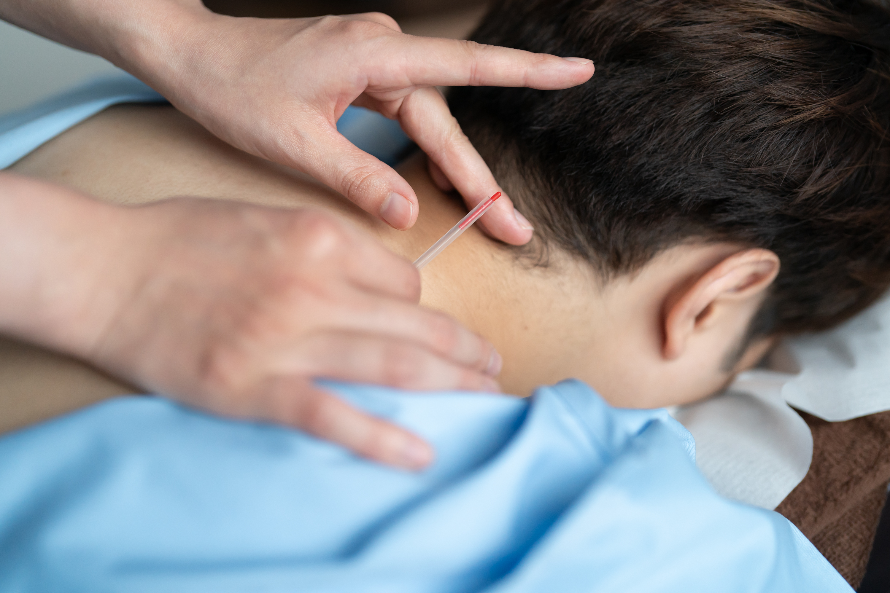 reCare道玄坂鍼灸院 ハリケア 【肩こり・腰痛を時短即効鍼治療】のメニュー画像