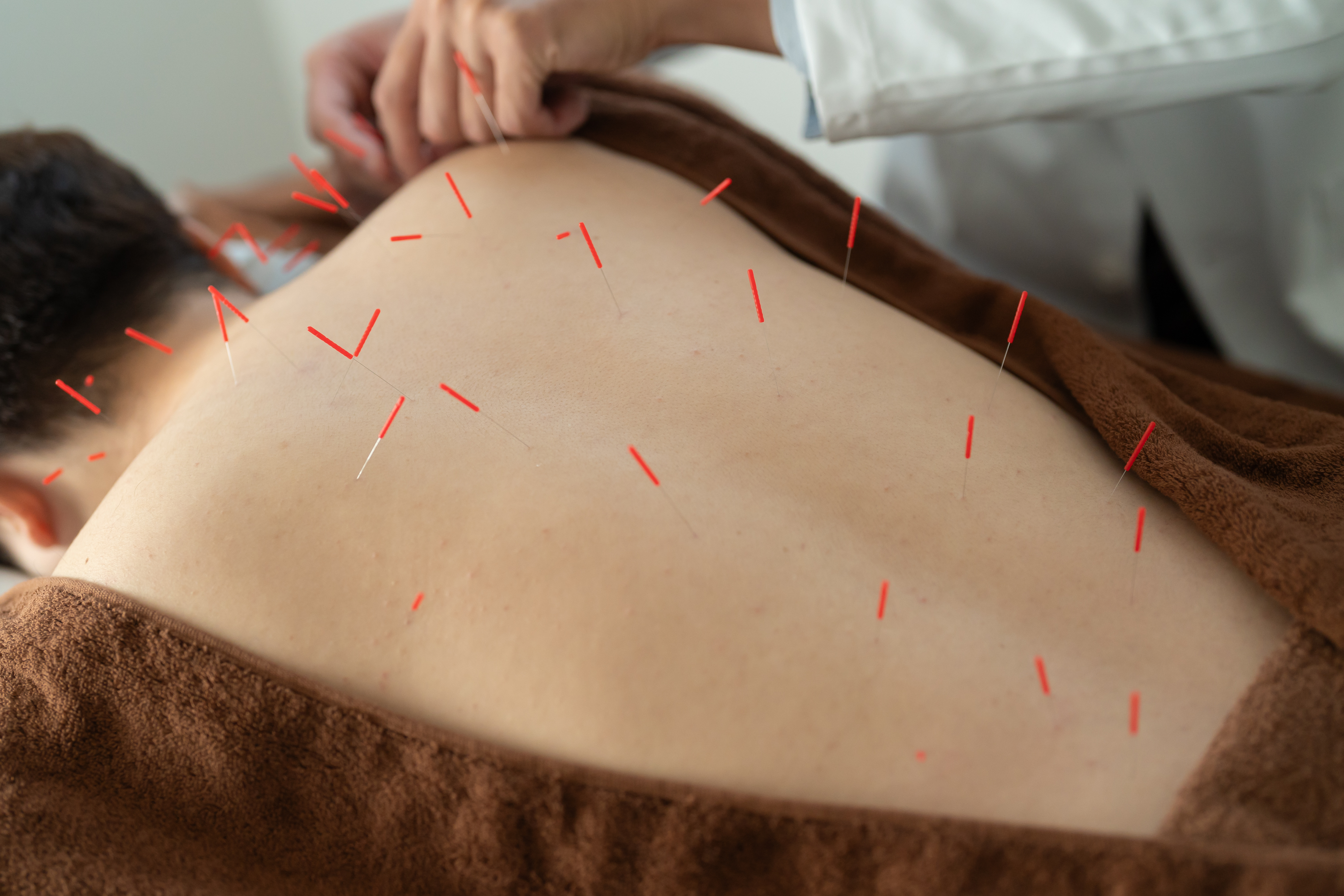 reCare道玄坂鍼灸院 ハリケア 【肩こり・腰痛を時短即効鍼治療】のメニュー画像