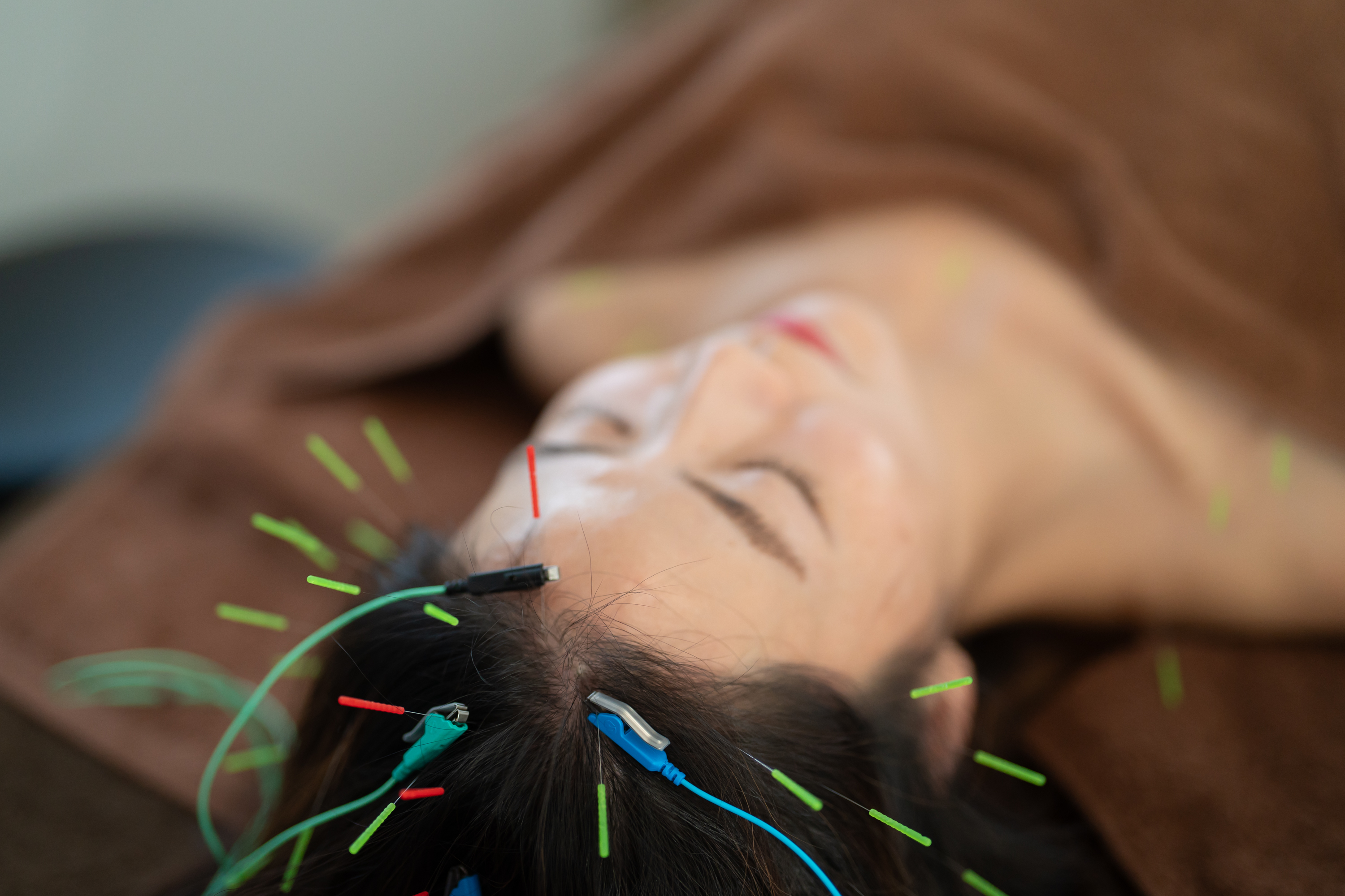 reCare道玄坂鍼灸院 ハリミン【睡眠の質改善　不眠解消】のメニュー画像