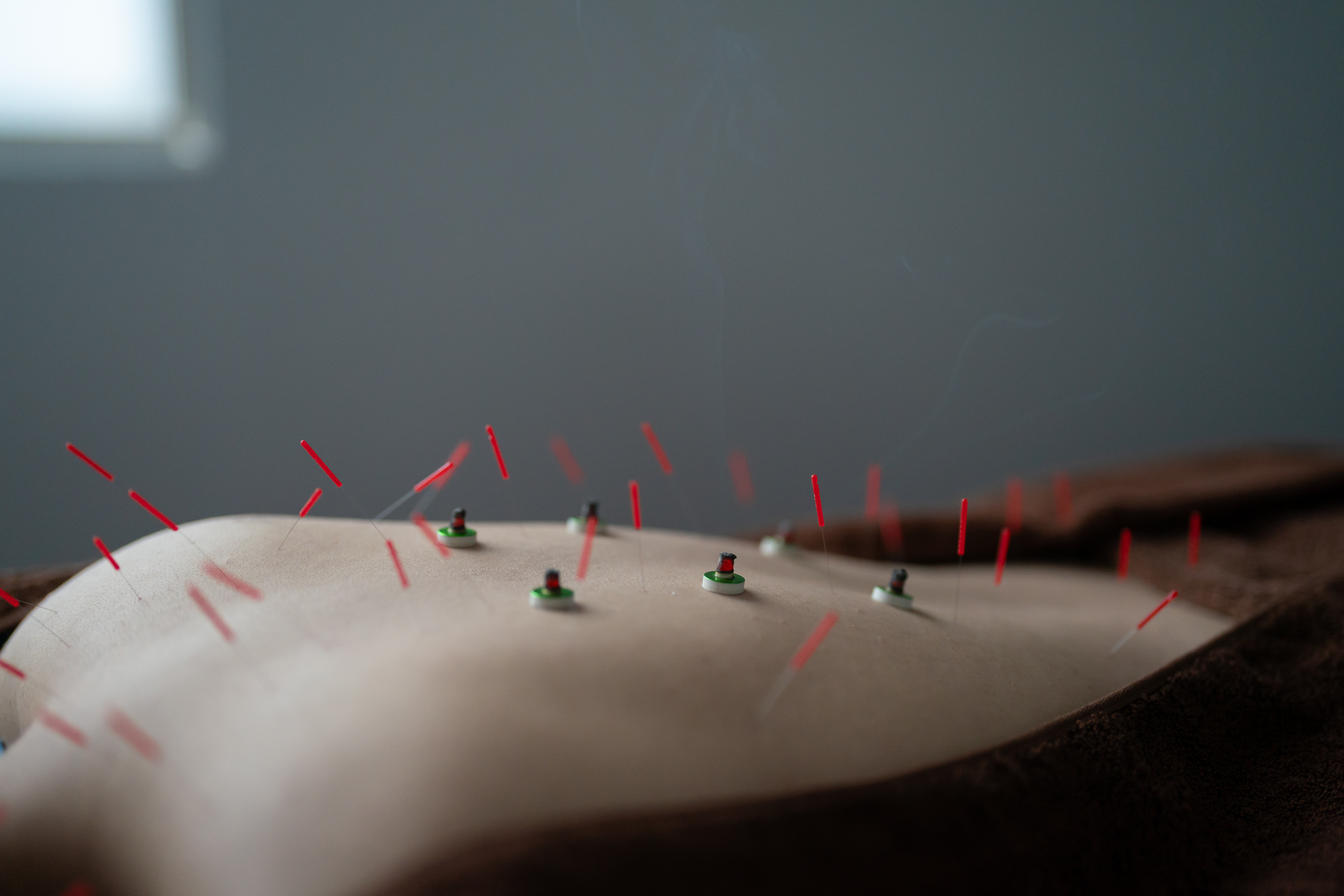 reCare道玄坂鍼灸院 伝統鍼灸治療【東洋医学と西洋医学の両面からアプローチ】のメニュー画像