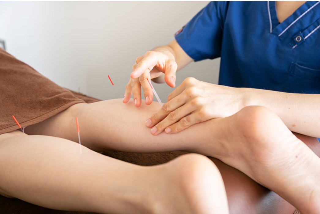 美容・不妊鍼灸 立川Ladies鍼灸マッサージ 産後ケア・更年期ケア ストレスリリーフ鍼灸のメニュー画像