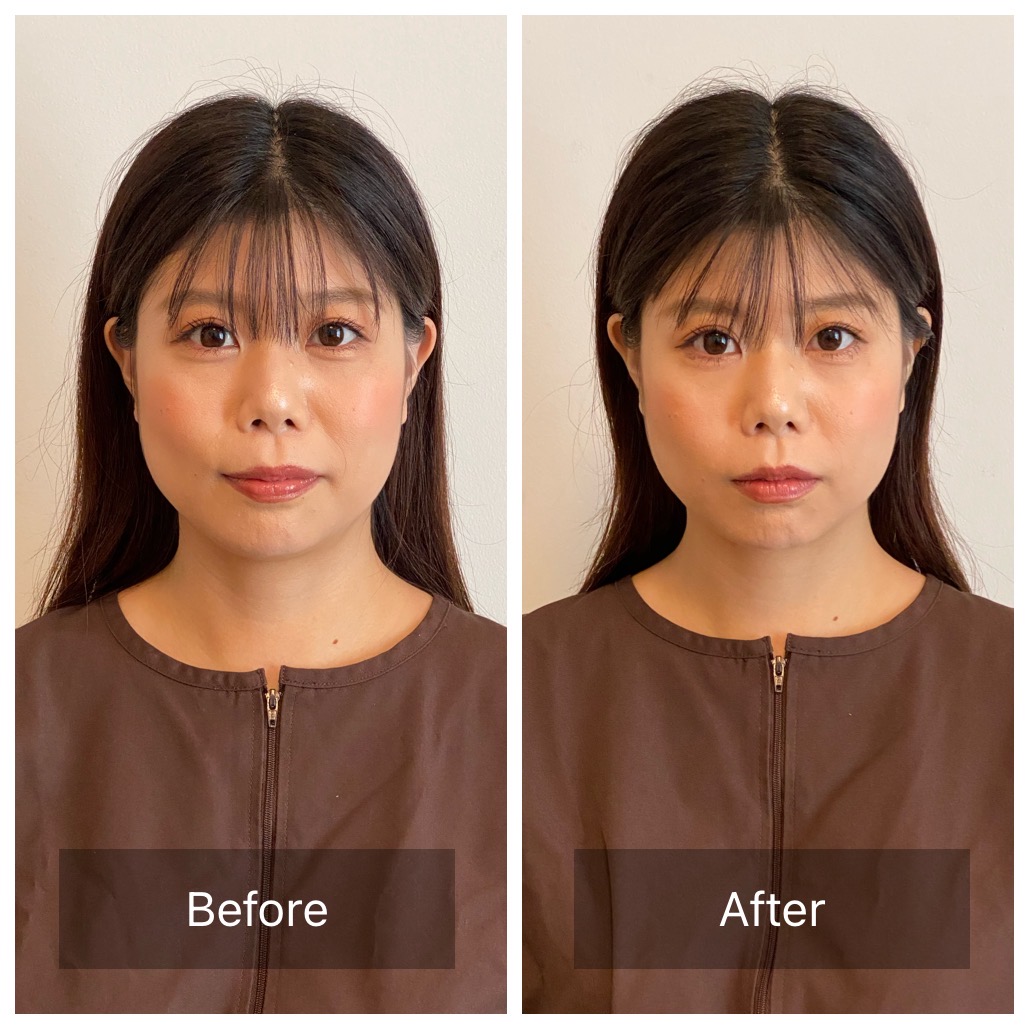 【女性とお子様のための東洋医学の鍼灸院】はりきゅう治療院malie 【初回】美容鍼灸治療のメニュー画像