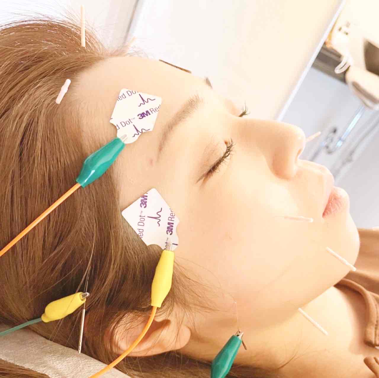 女性専門鍼灸サロン　はにかむ リフトアップコースのメニュー画像