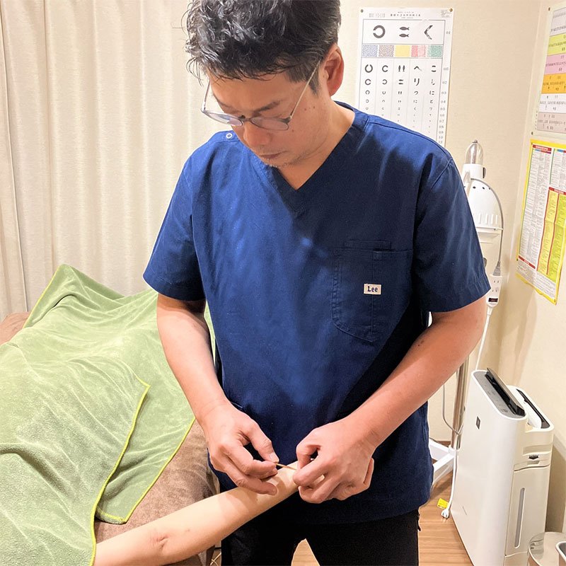 楽笑鍼灸院 一般鍼灸のメニュー画像