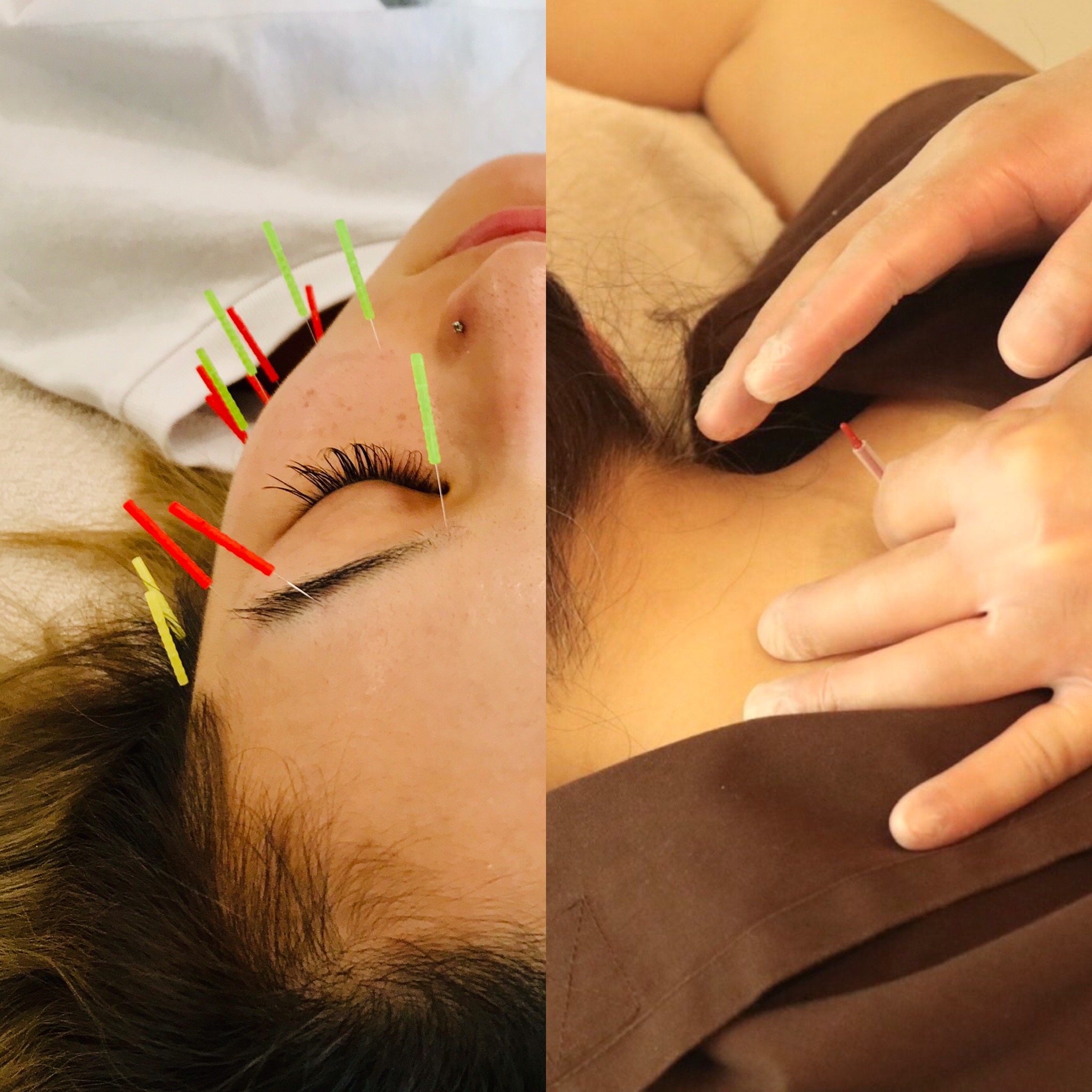 TANSAN鍼灸院 〜Ｋ〜 （初回）【 face ＋ body 】のメニュー画像