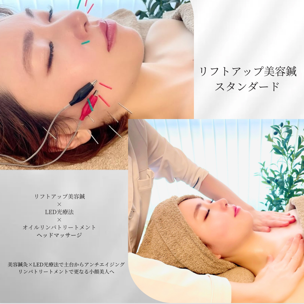 小顔・アンチエイジング鍼灸 めい鍼灸院 -meishinkyu- 【初回限定】リフトアップ美容鍼 スタンダードのメニュー画像