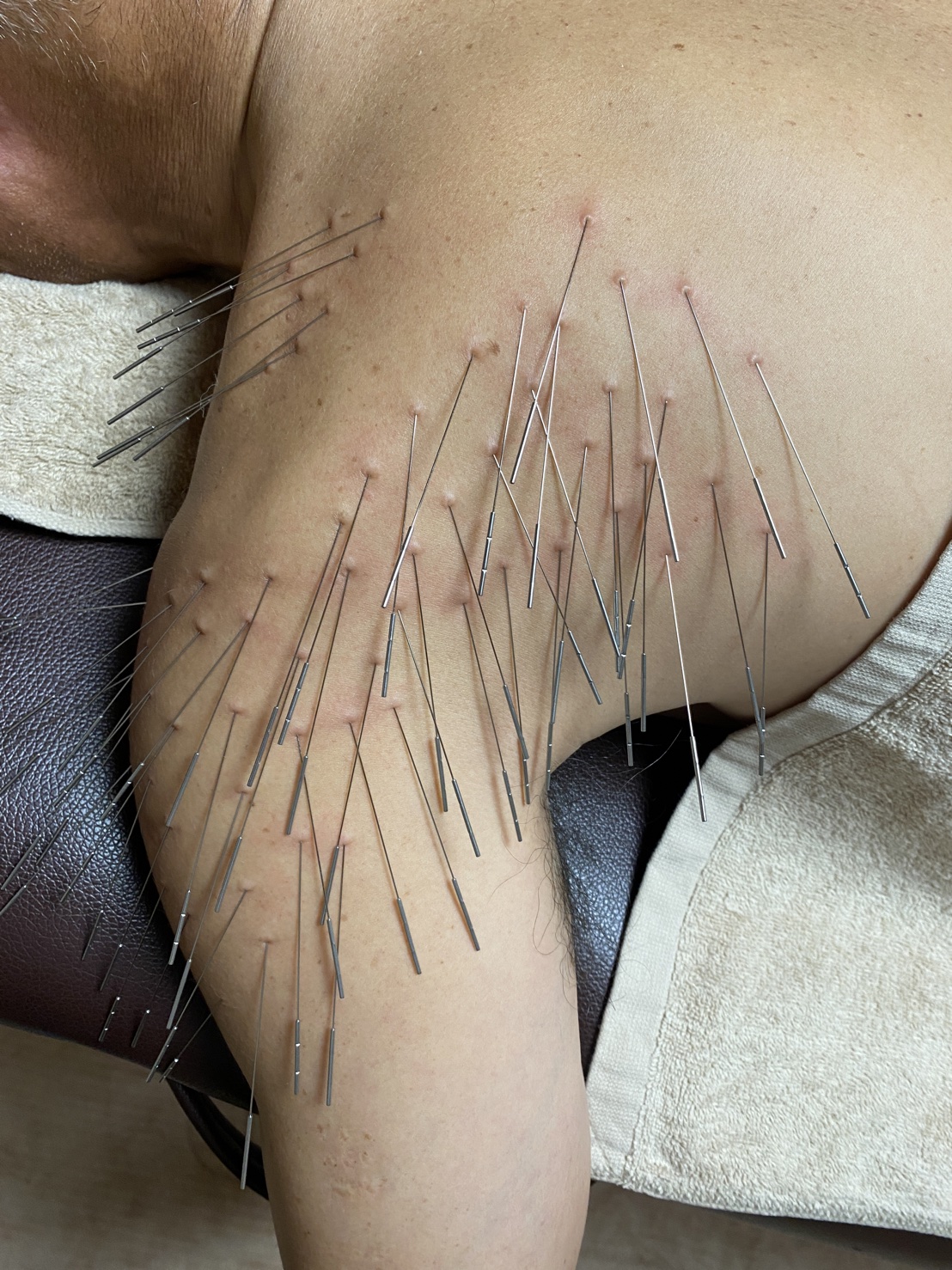 maryu358鍼灸・整体院 ルート治療20のメニュー画像