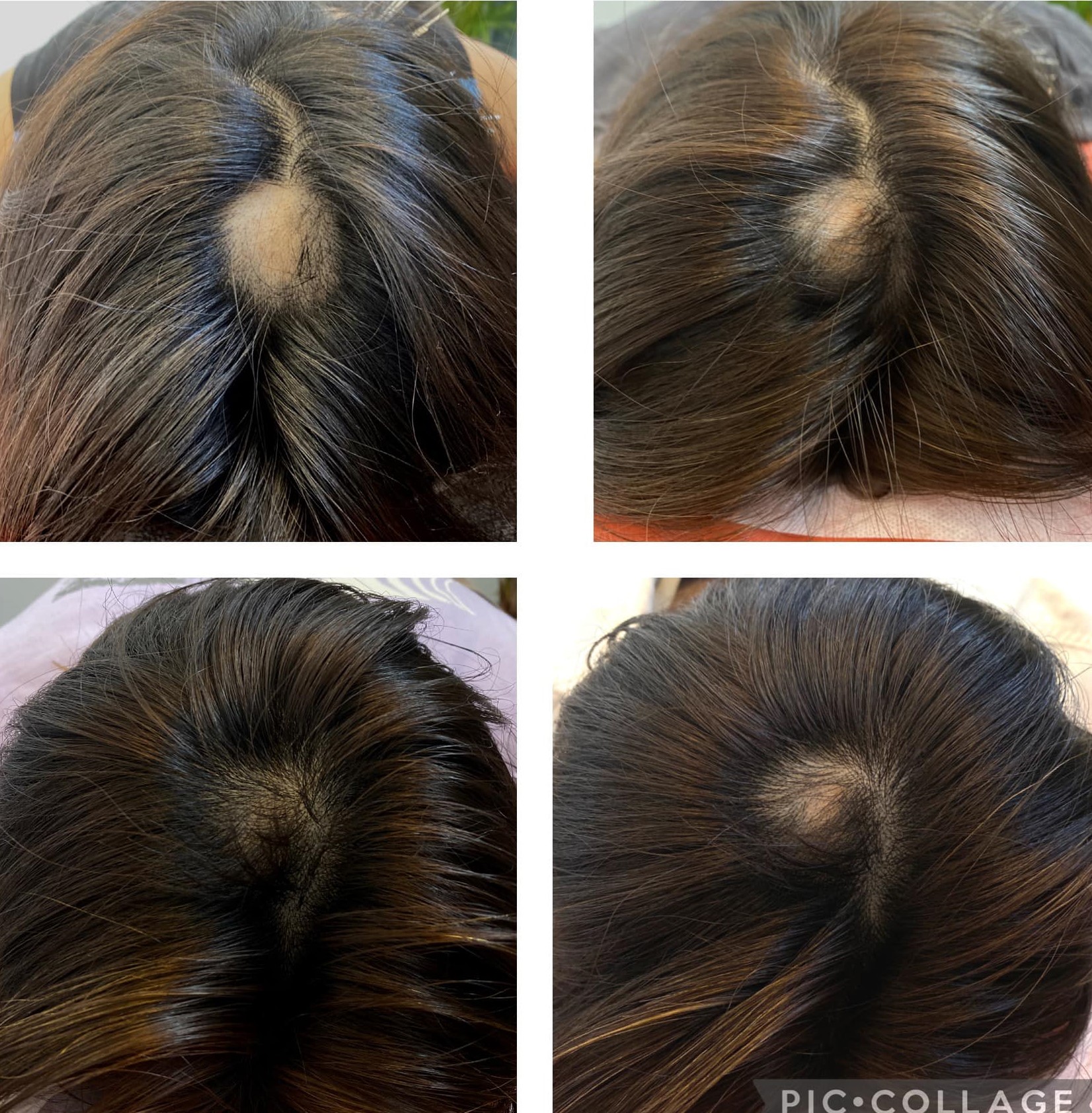 maryu358鍼灸・整体・ルート治療院 薄毛ルート治療のメニュー画像