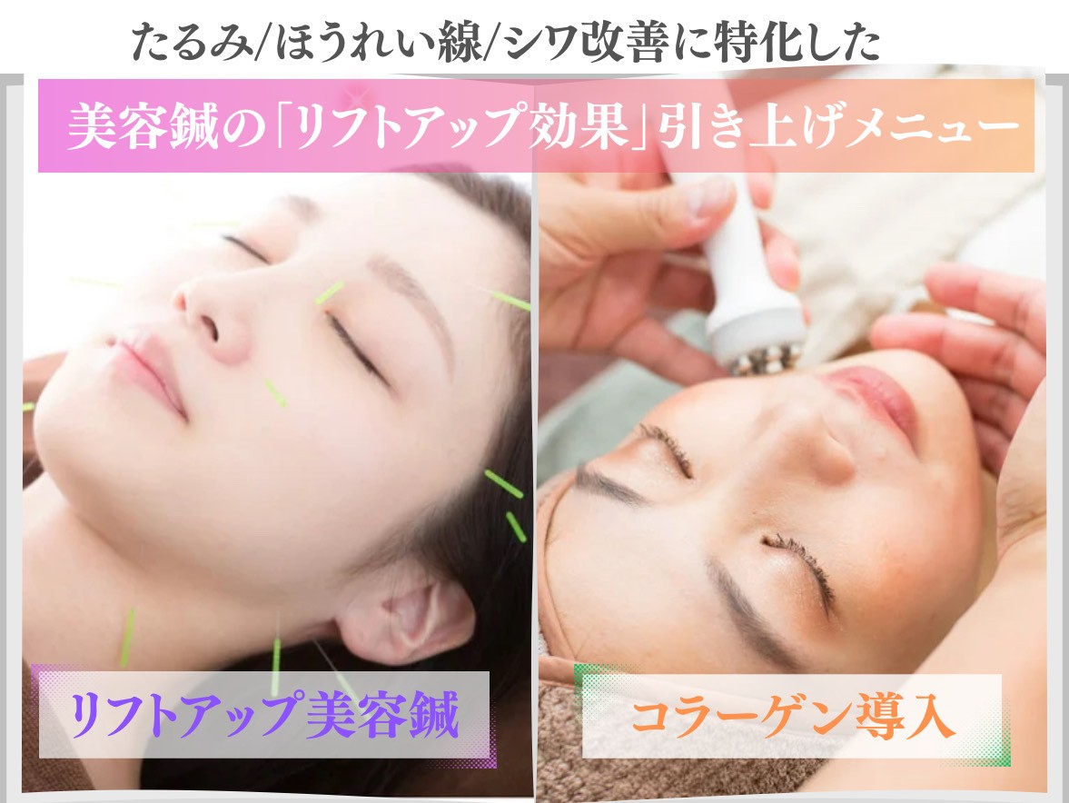 【メリハリ小顔・透明美肌】お顔の美容専門サロン-ハリステリア-≪H・S≫ 小顔リフトアップ美容鍼×コラーゲン導入のメニュー画像