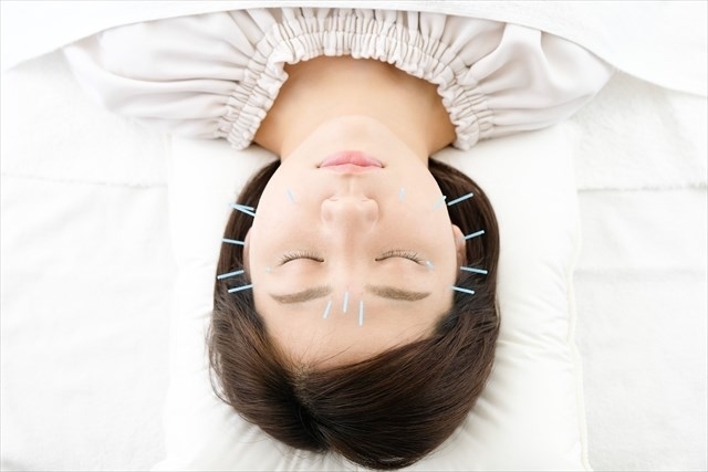 ひろ中鍼灸マッサージ院 スペシャル美容鍼のメニュー画像