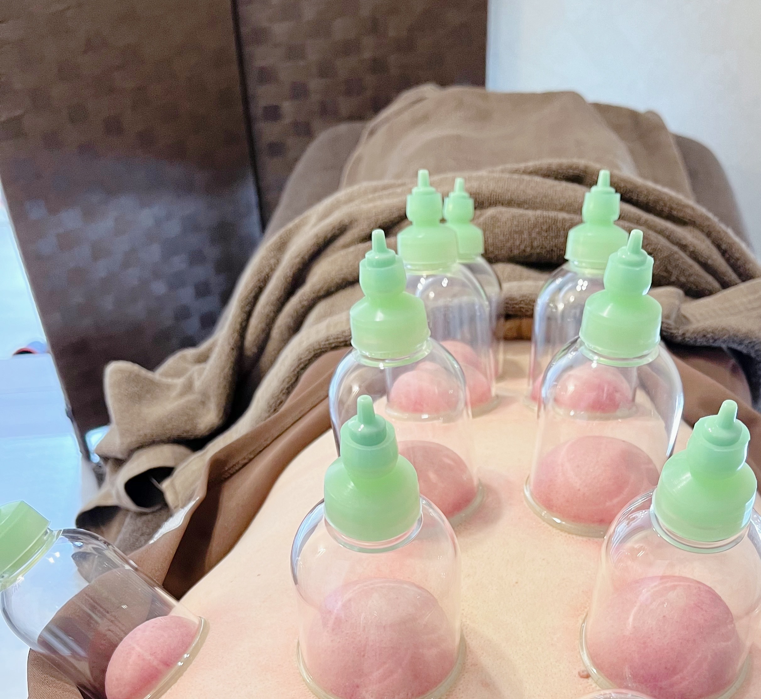女性専門鍼灸サロン はにかむ 人気オプション☆吸い玉のメニュー画像