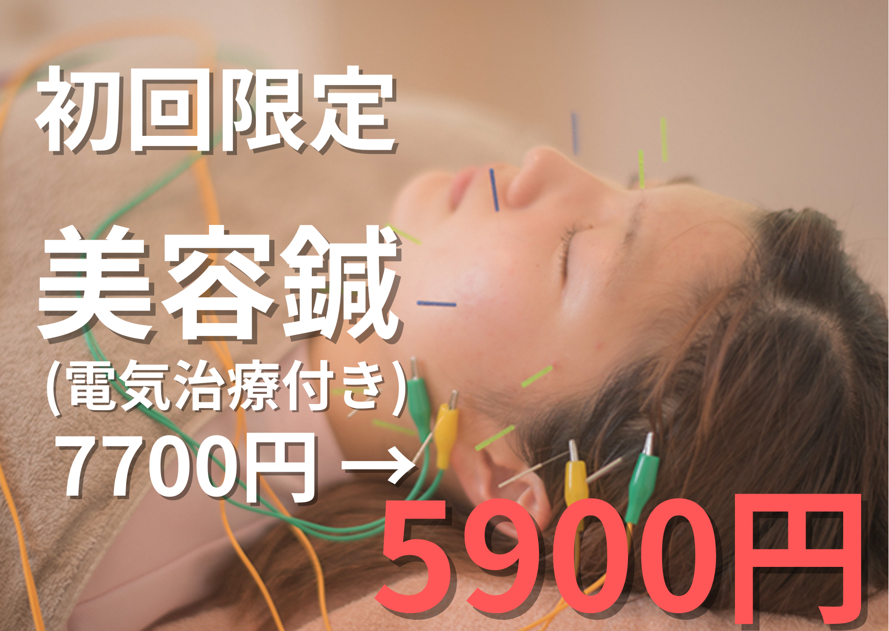 hodoyoku(ﾎﾄﾞﾖｸ) ~total body care studio~ 【初回限定】美容鍼（電気治療付き）通常7,700円 → 5900円！！のメニュー画像