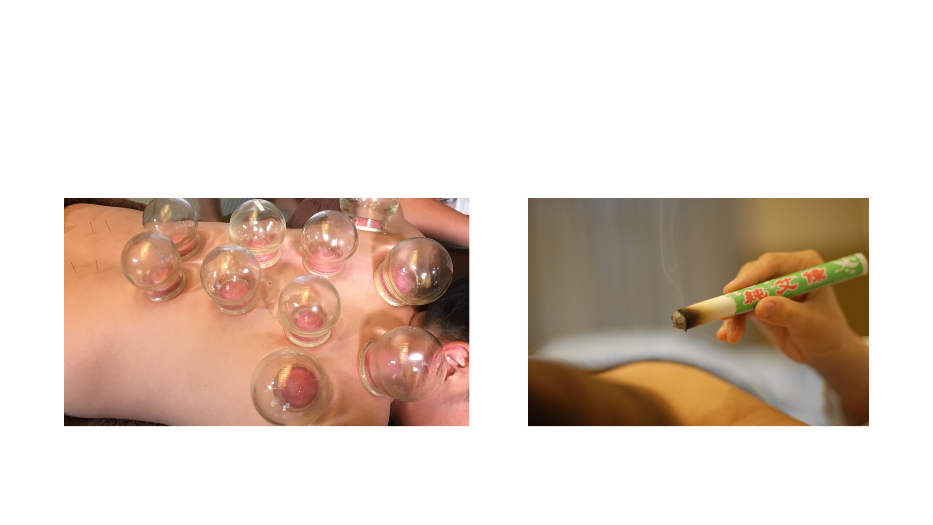 KAKA鍼灸院 健体鍼のメニュー画像