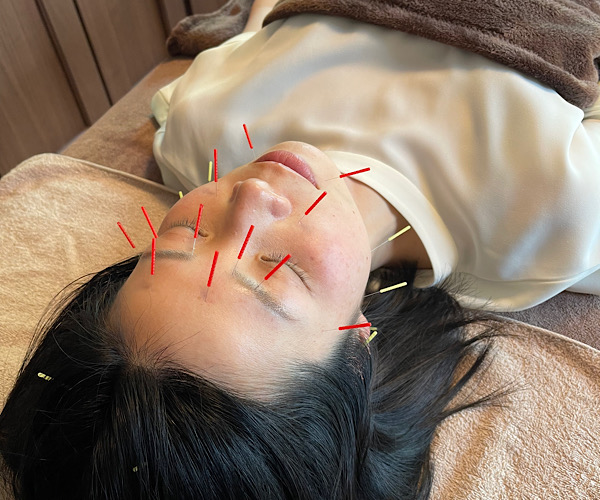 女性と子どものためのはり・きゅう治療院　Mother Earth [初回限定] お試しプレミアム美容鍼＆整体のメニュー画像