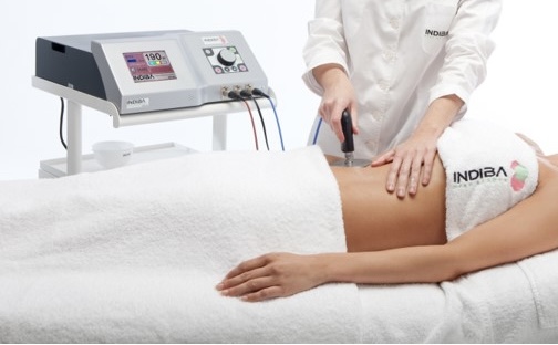 alba暁子鍼灸治療院 【再来限定】鍼・お灸・吸い玉・インディバ　75分コースのメニュー画像