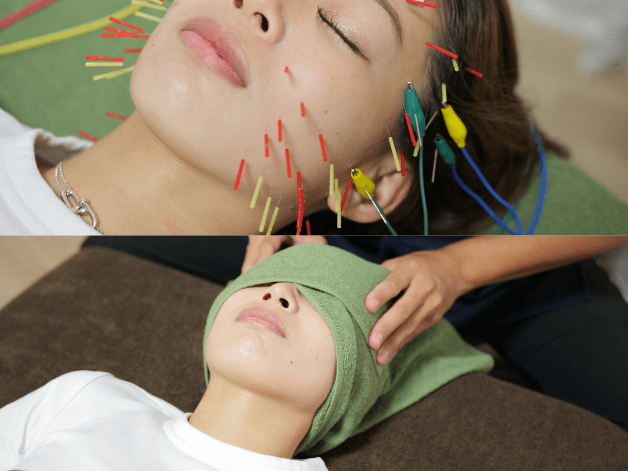 美顔鍼灸整体院凛と慶 1回目から効果実感の電気鍼+脳疲労改善ヘッドスパのメニュー画像