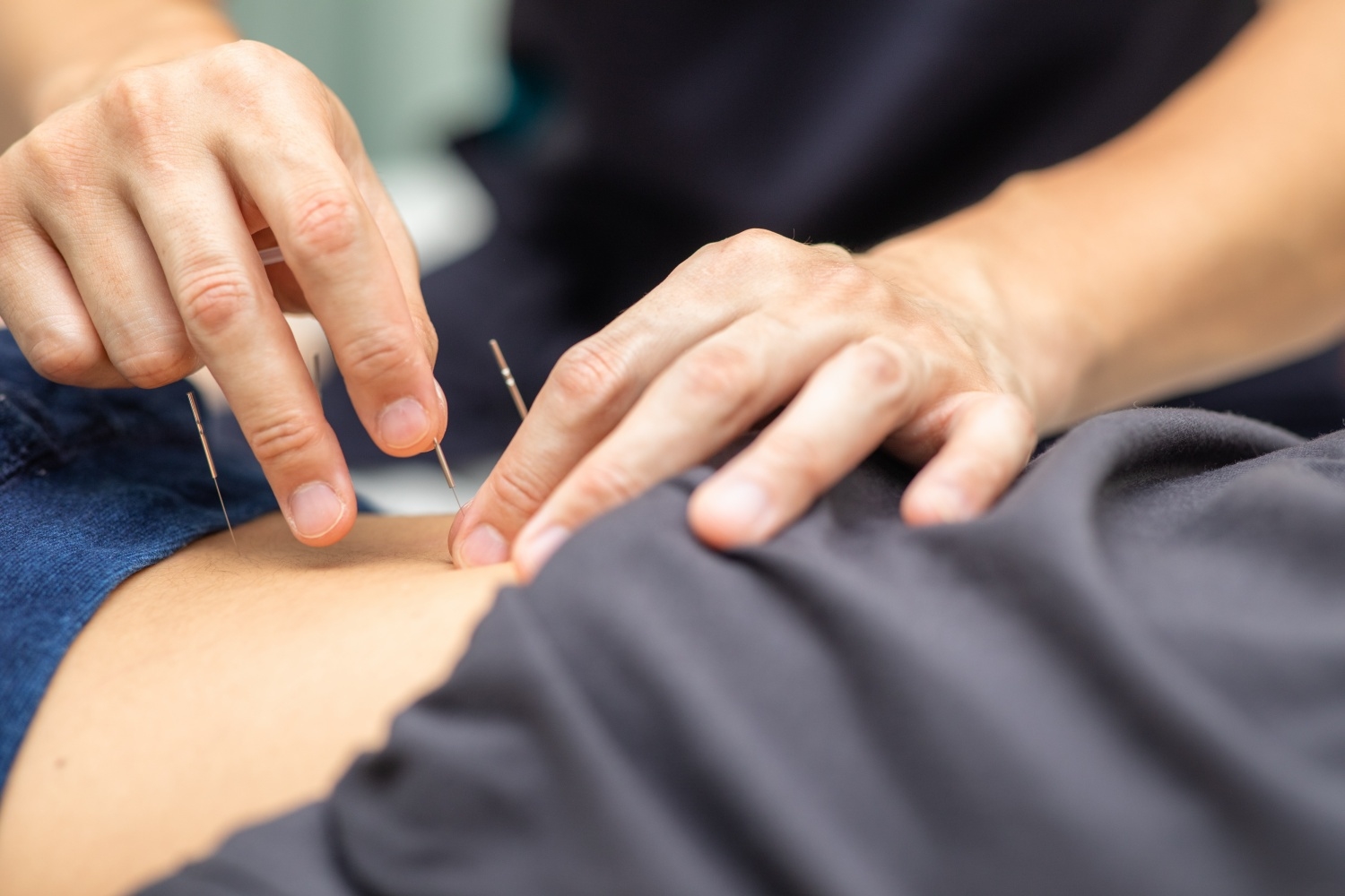 あおば鍼灸院接骨院竹の山店 鍼灸治療のメニュー画像