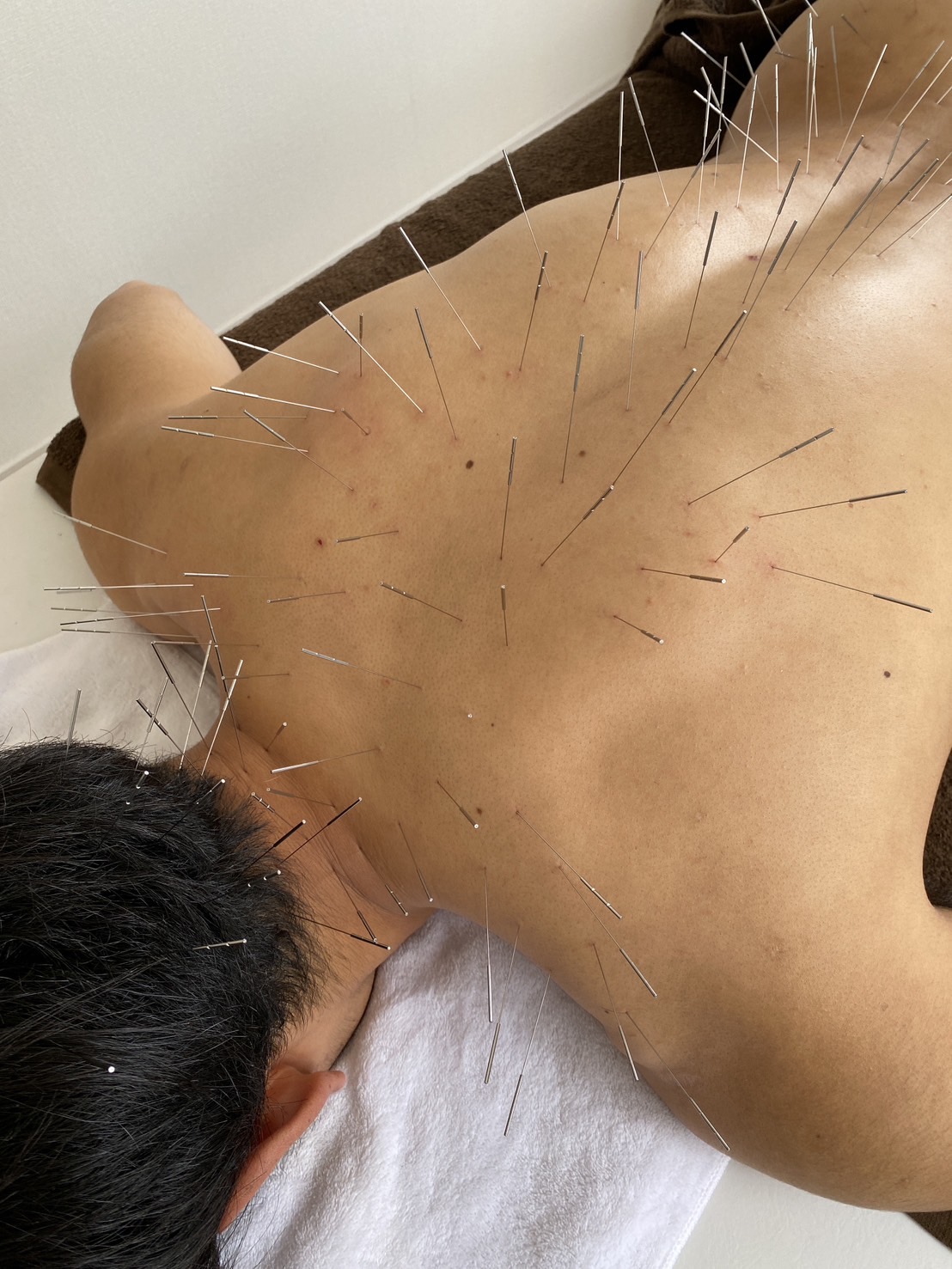 maryu358鍼灸・整体院 ルート治療40のメニュー画像