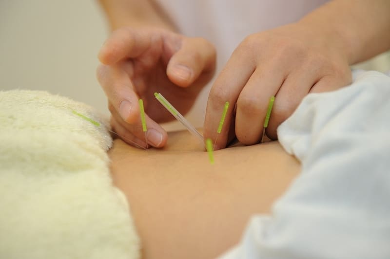 みずの坂鍼灸マッサージ整骨院 整体院 ②鍼灸コース／症状回復施術のメニュー画像