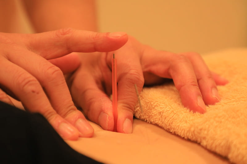 みずの坂鍼灸マッサージ整骨院 整体院 ③鍼灸と筋肉調整コース／症状回復施術のメニュー画像