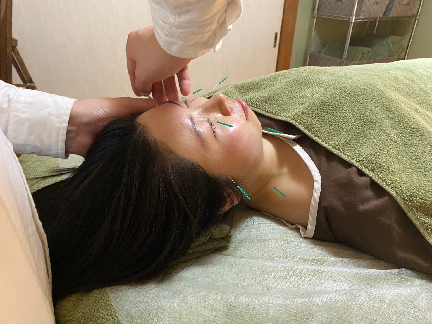 Oracule丸亀鍼灸院 日本鍼灸プレミアムコース(美容鍼灸コース)のメニュー画像