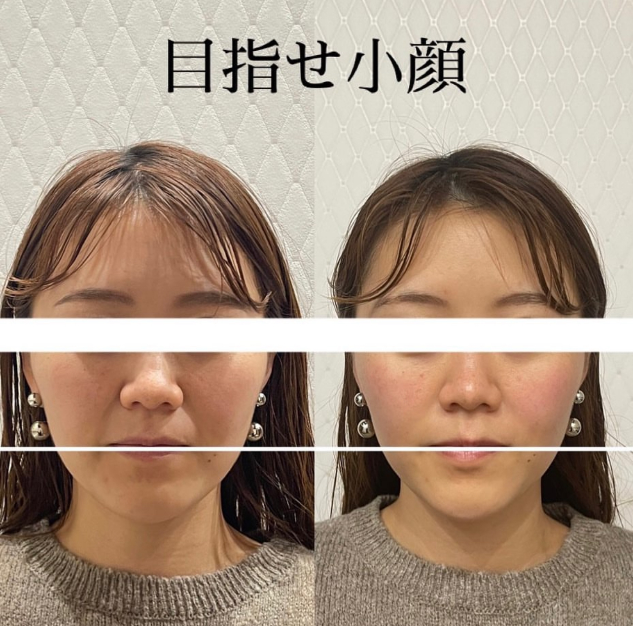 HEALJOY-ヒールジョイ- 小顔矯正のメニュー画像