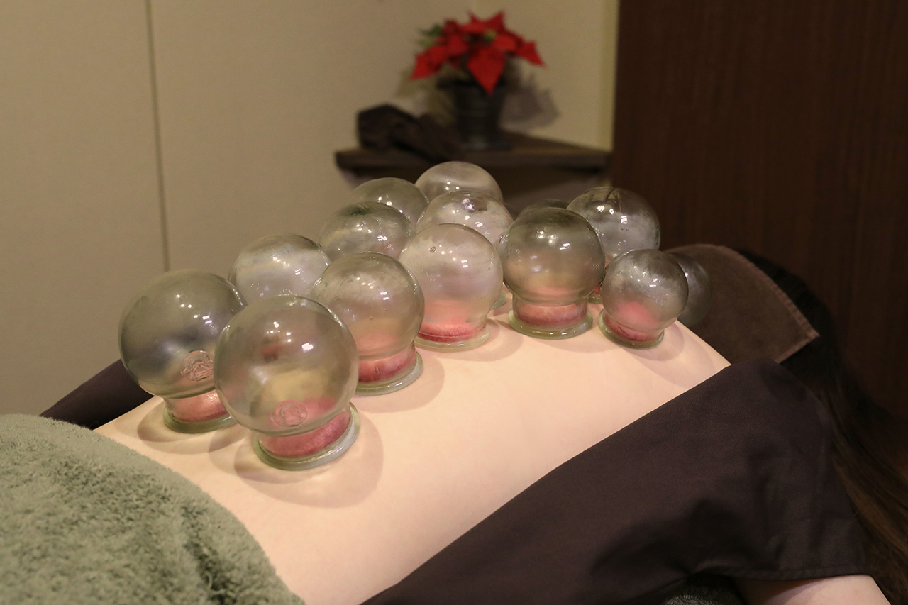 ORIENT THERAPY　ルート治療・鬼神美容鍼（ルート治療ベース）・電気美容鍼・刺さない極美鍼・難聴特化型鍼サロン 吸い玉療法「美容鍼に追加の場合」のメニュー画像