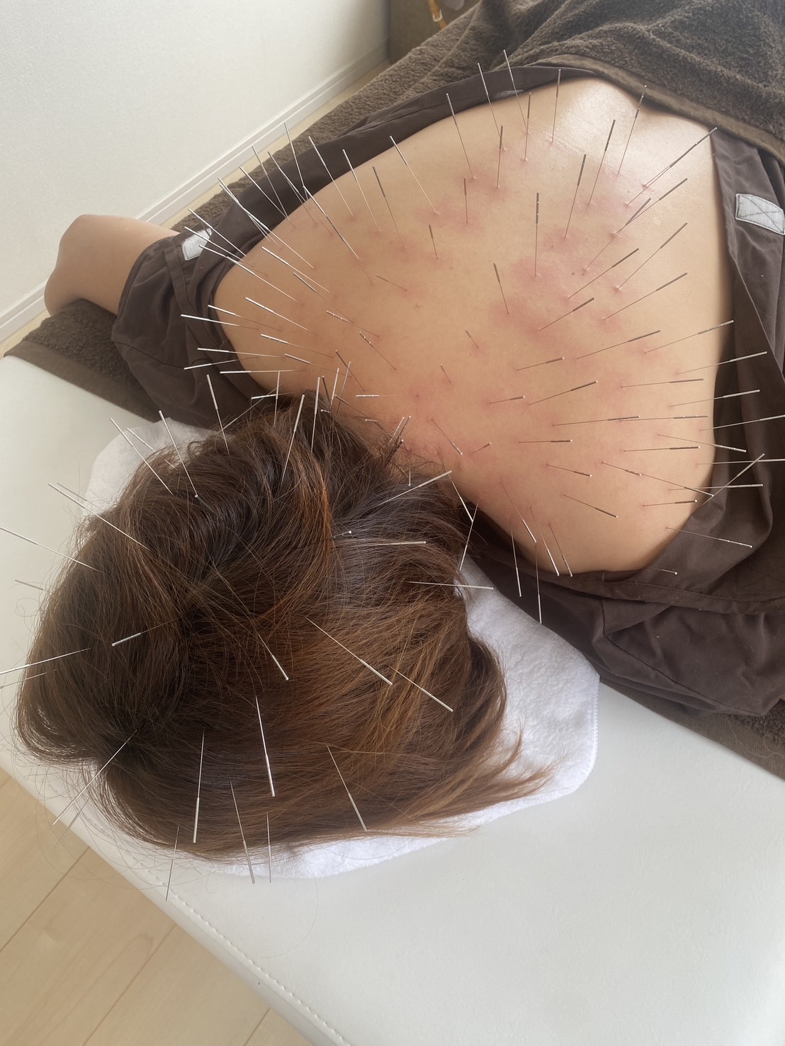 maryu358鍼灸・整体院 ルート治療60のメニュー画像