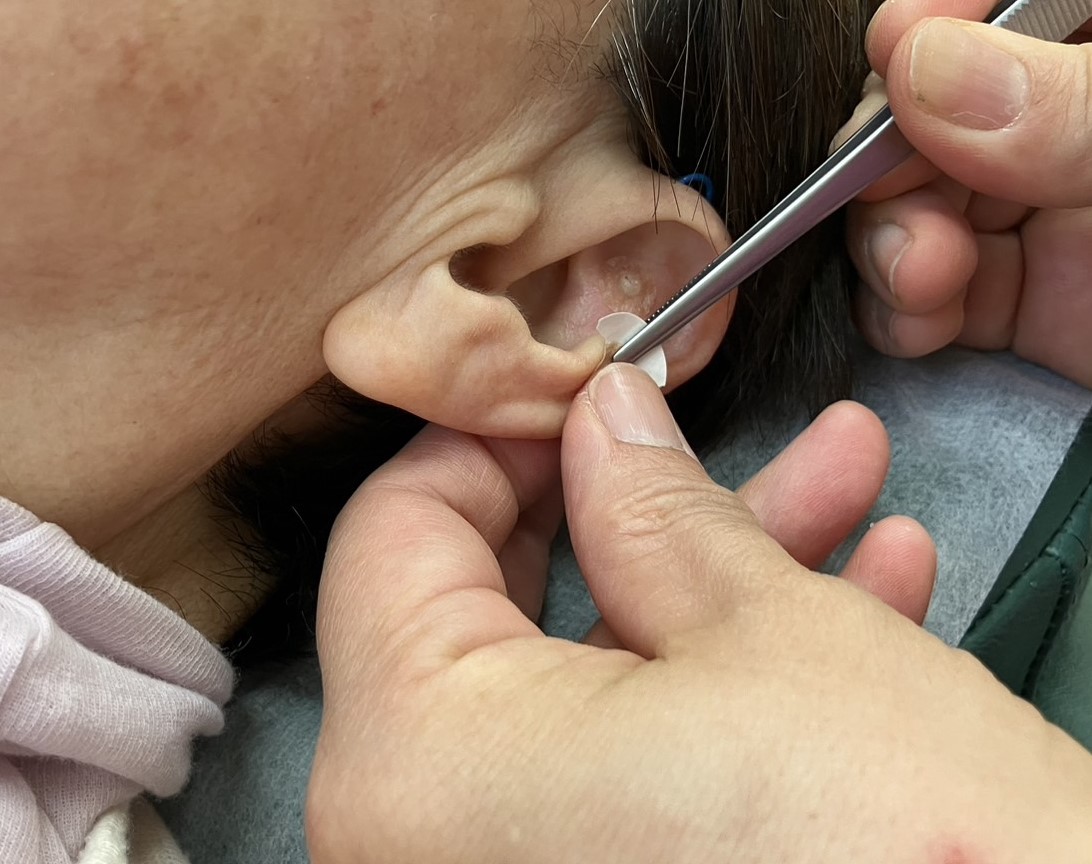 まき鍼灸院・柔道整復院 耳介画像全身はりきゅうのメニュー画像