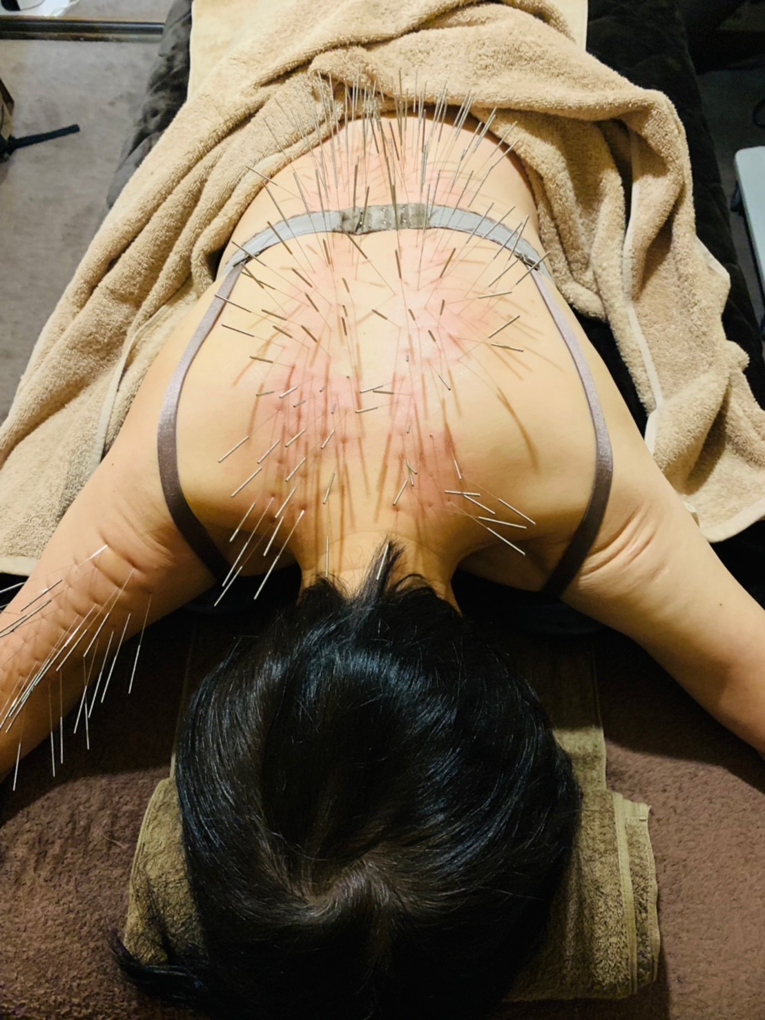 よしよし　はりきゅう院 ルート治療　30分のメニュー画像