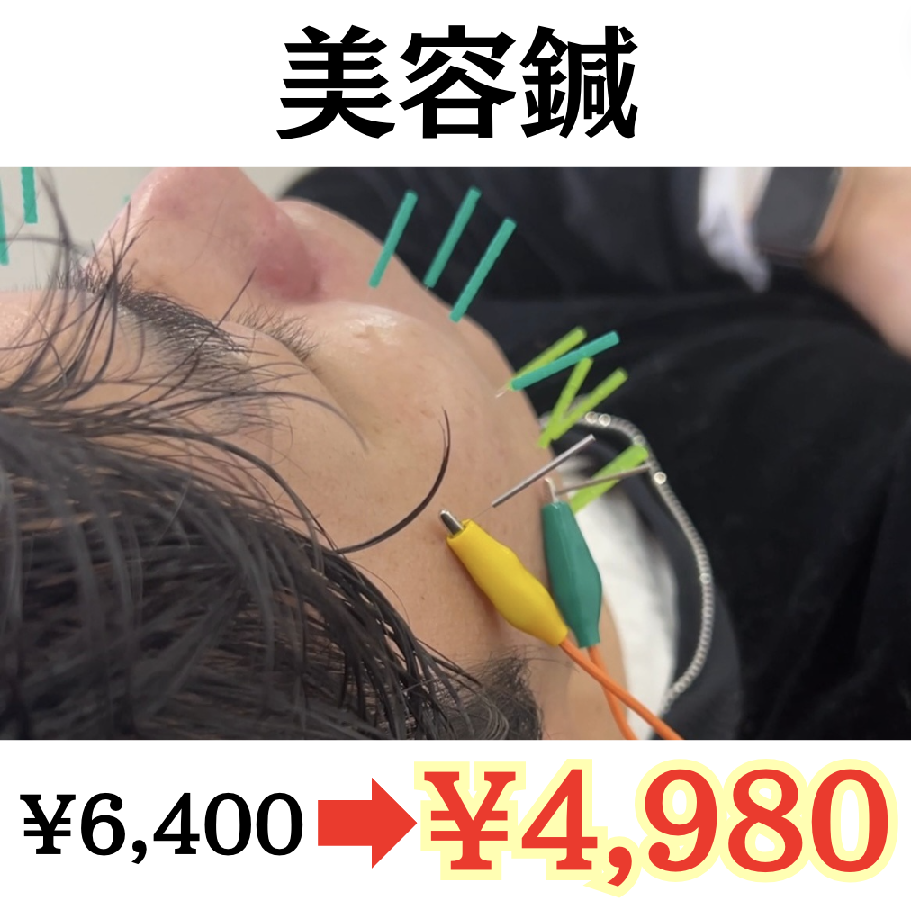 美容鍼灸整体サロンmemola 【初回：期間限定口コミ割】美容鍼 60分のメニュー画像