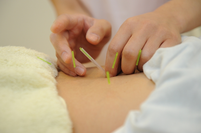 みずの坂鍼灸マッサージ整骨院 整体院 鍼灸施術のメニュー画像