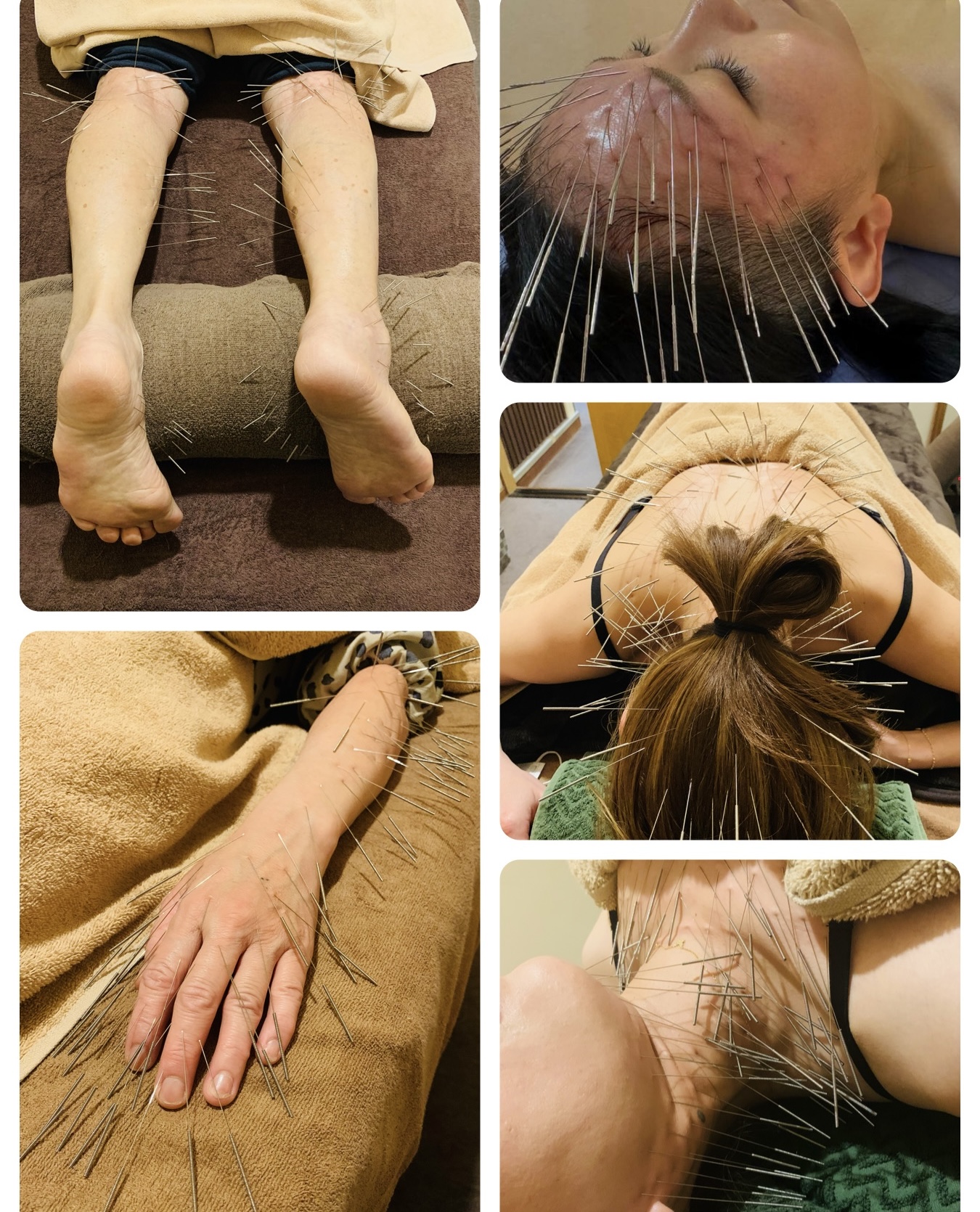 よしよし　はりきゅう院 ルート治療　90分のメニュー画像