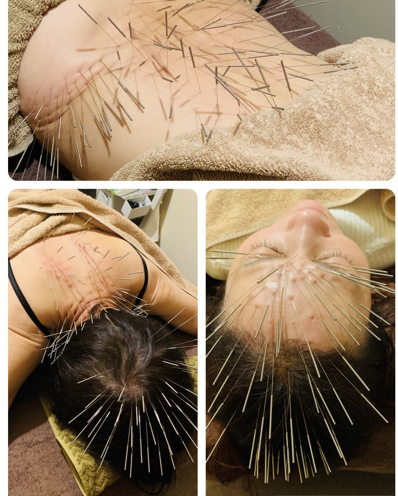 よしよし　はりきゅう院 ルート治療　60分のメニュー画像