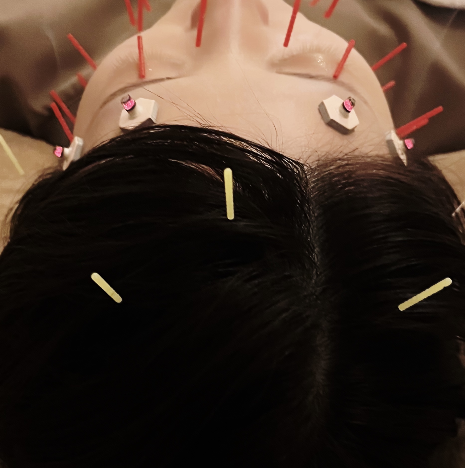 HARiET ライト美容鍼のメニュー画像