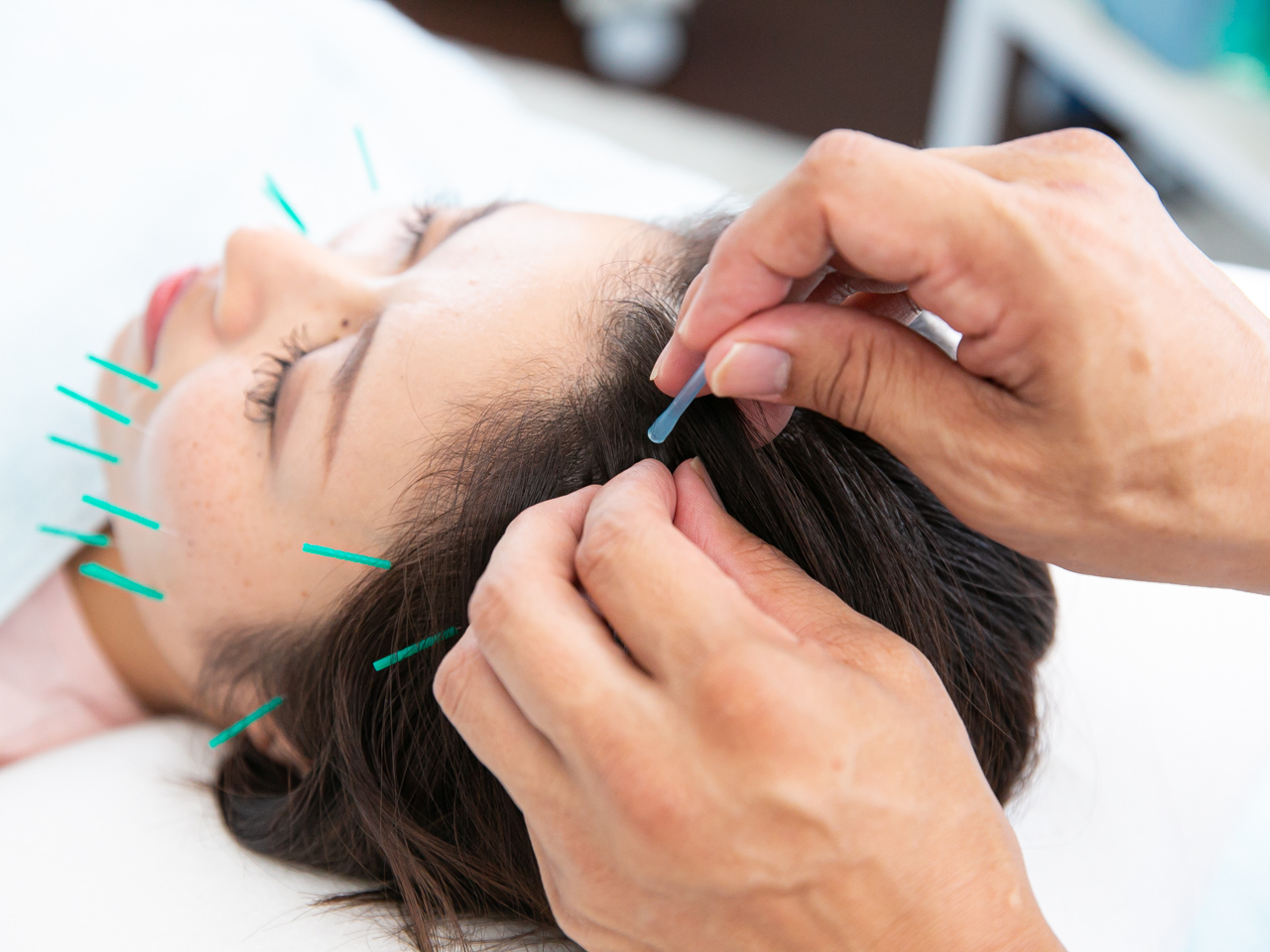 ラメール鍼灸院 『鍼灸』不眠サヨナラ　睡眠鍼のメニュー画像