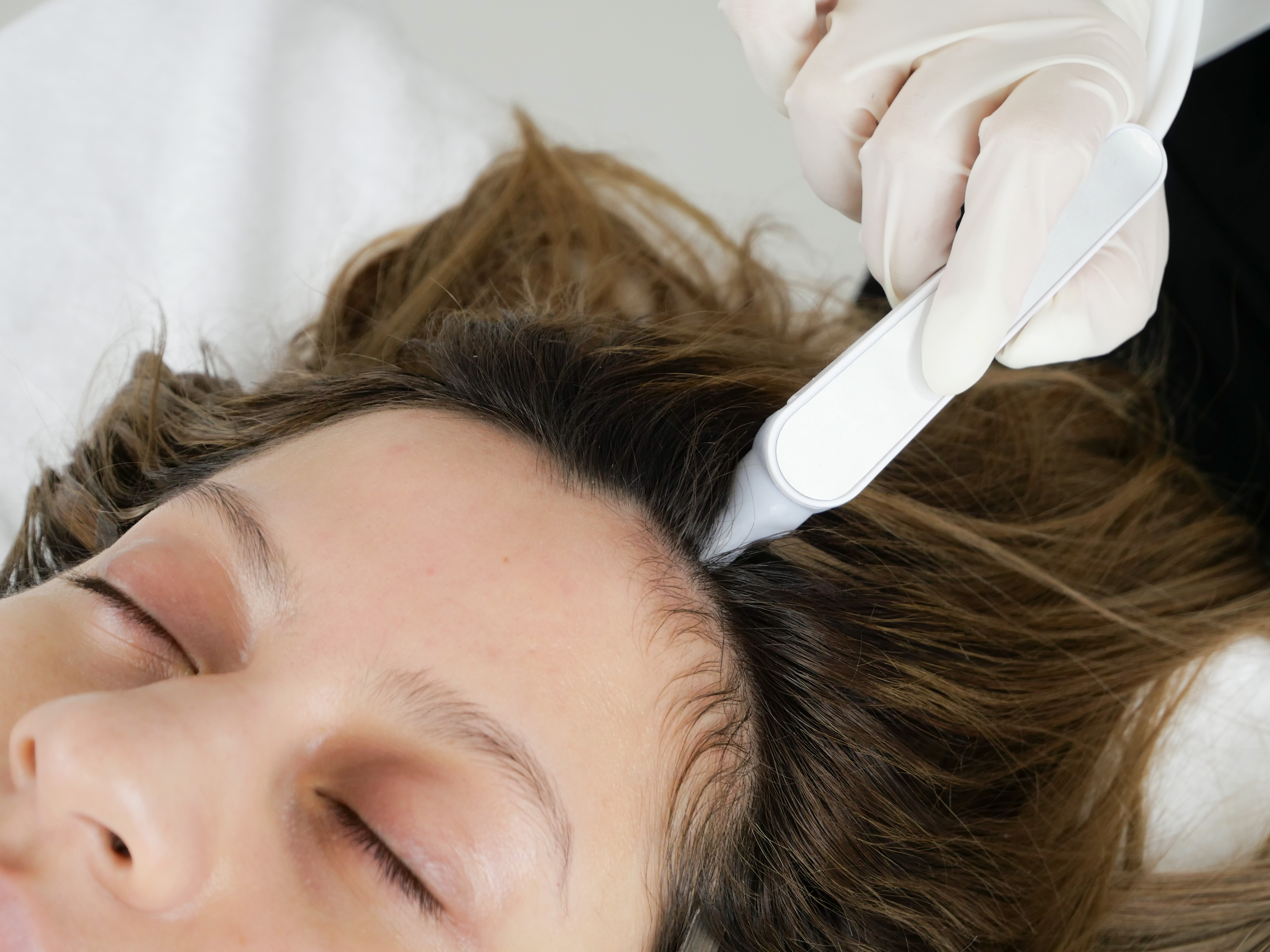 くじら鍼灸・整体院 初回体験育毛コース　薄毛や抜け毛、円形脱毛などでお悩みの方へのメニュー画像