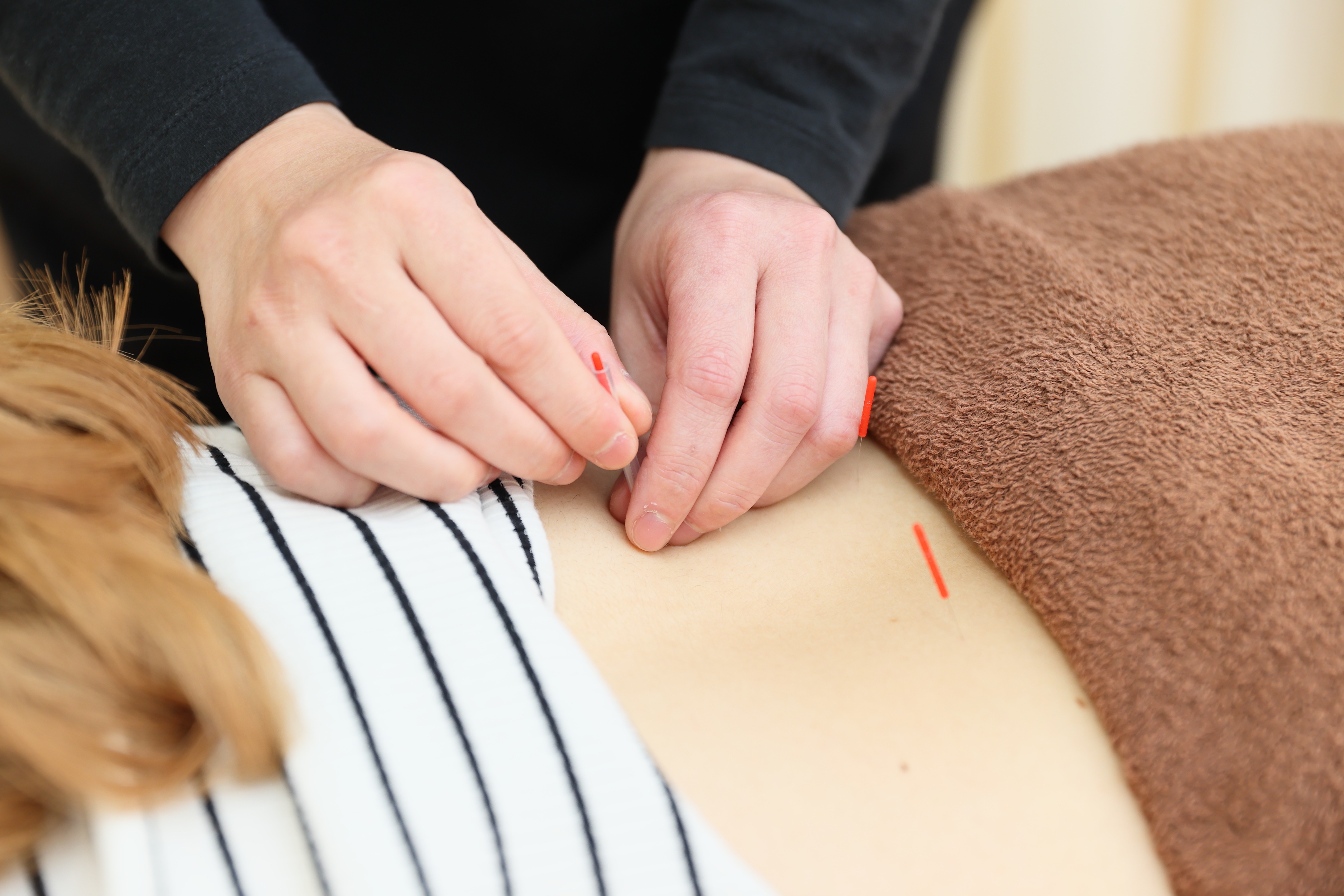 ただき接骨院 整体院 高関院 鍼治療　※初めての方はお選びいただけませんのメニュー画像