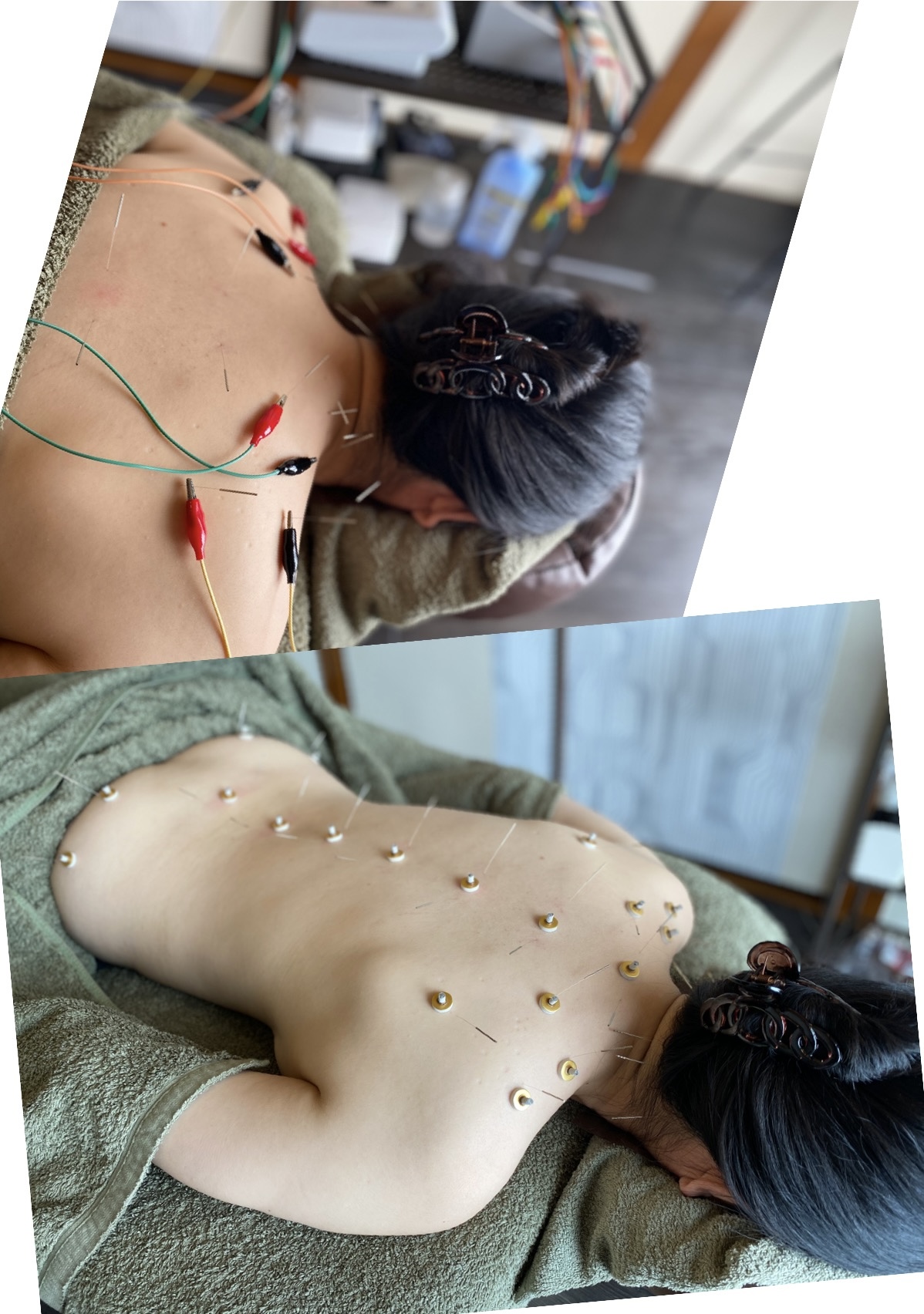 はり灸マッサージ統合治療院Hui (ホイ) 鍼灸全身60分コース¥7000(深層マッサージ1〜2部位込み)のメニュー画像