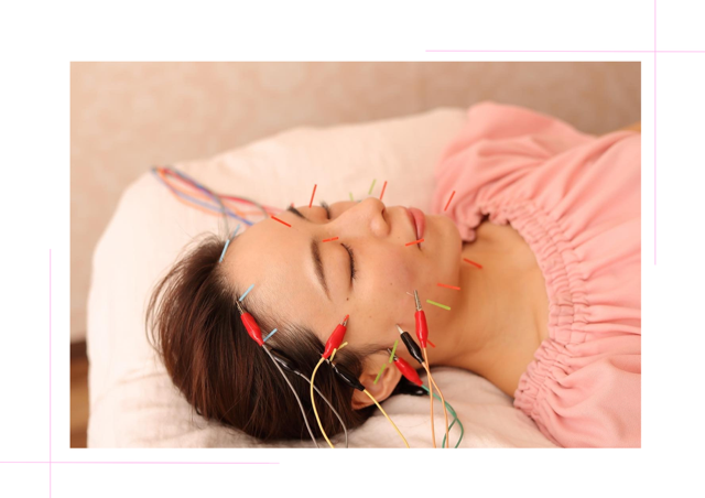 meilong 恵比寿mana院 小顔電流鍼 90分【お顔の浮腫みにオススメ♪】のメニュー画像