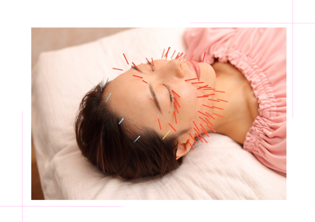 meilong 恵比寿mana院 美容鍼灸90分　この金額から初回40％OFFのメニュー画像