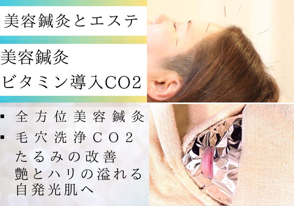 さつき鍼灸整骨院 【リフトアップ】【くすみ･たるみ毛穴】　全方位型美容鍼灸＋ビタミン導入CO2のメニュー画像