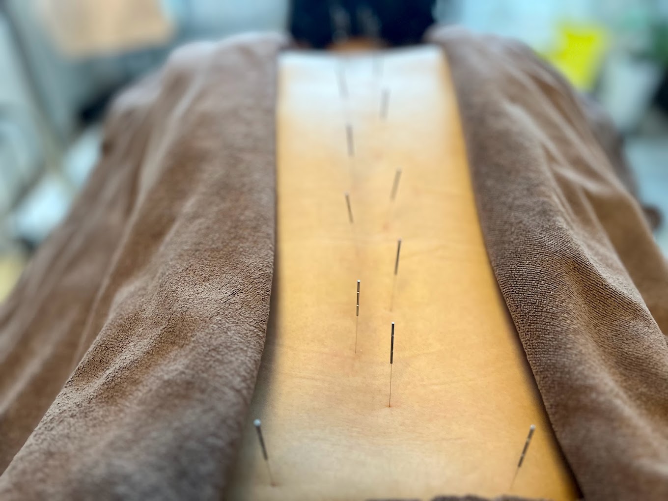 村上鍼灸院 Treatments for travelersのメニュー画像
