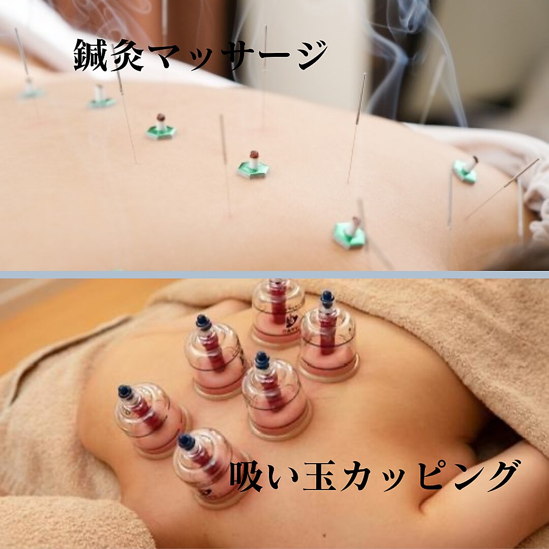 OhanaRoom鍼灸治療院 【子宝鍼灸】(鍼灸治療45分、よもぎ蒸し30分。但しよもぎ蒸しは禁忌の時を除く)のメニュー画像