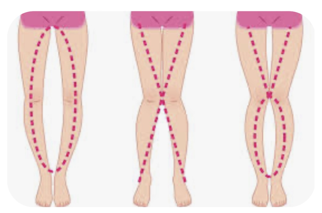 整体・鍼灸サロンAnon 【姿勢美容矯正コース】骨格/骨盤矯正/O脚/X脚のメニュー画像