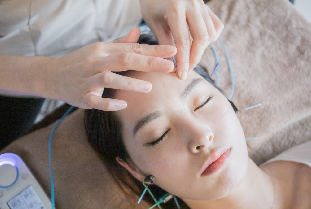 Harifa鍼灸院福岡博多院 リフトアップ美容鍼【初回限定】¥3980のメニュー画像