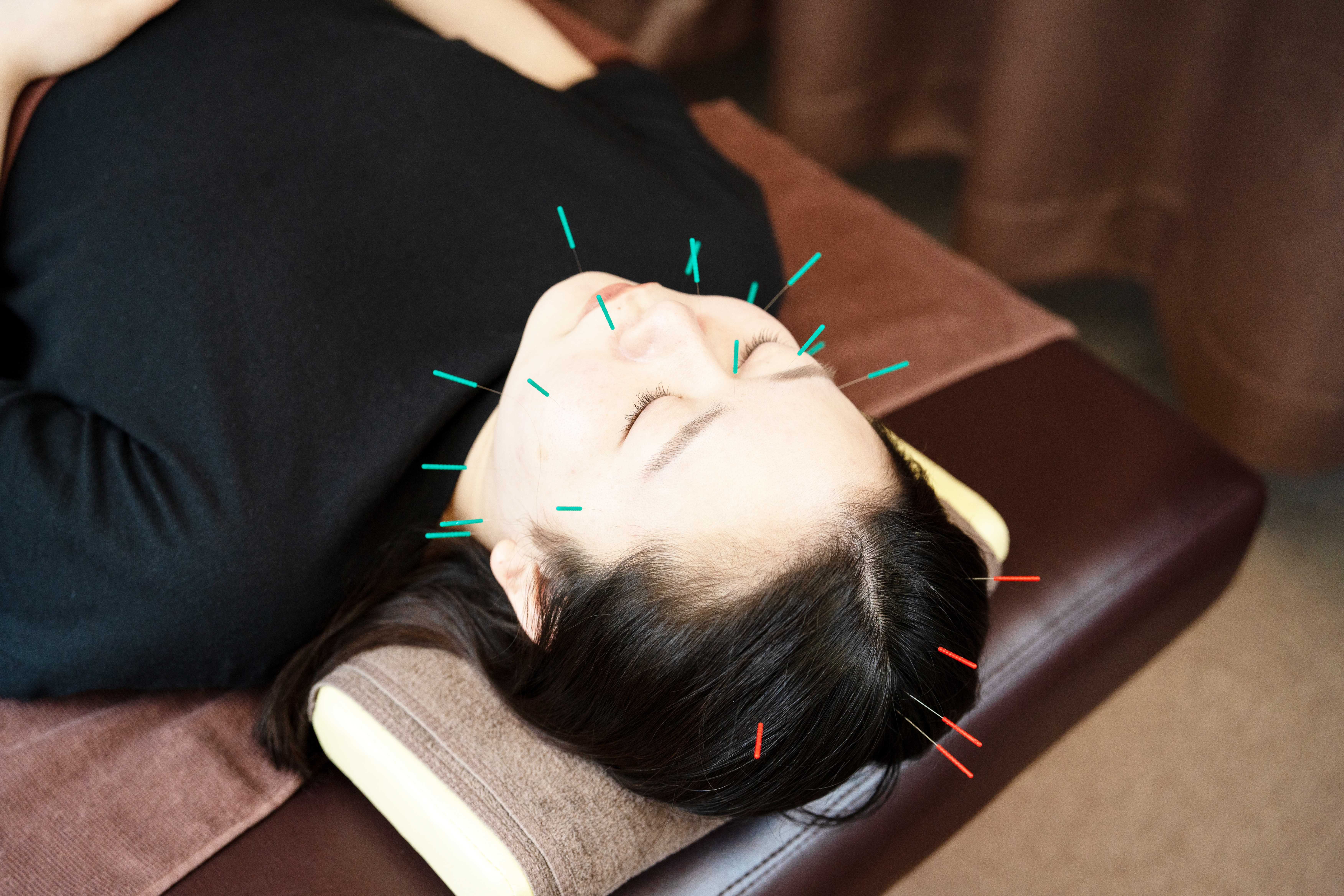 ルヌーラ　total spa 美顔鍼　３０分のメニュー画像