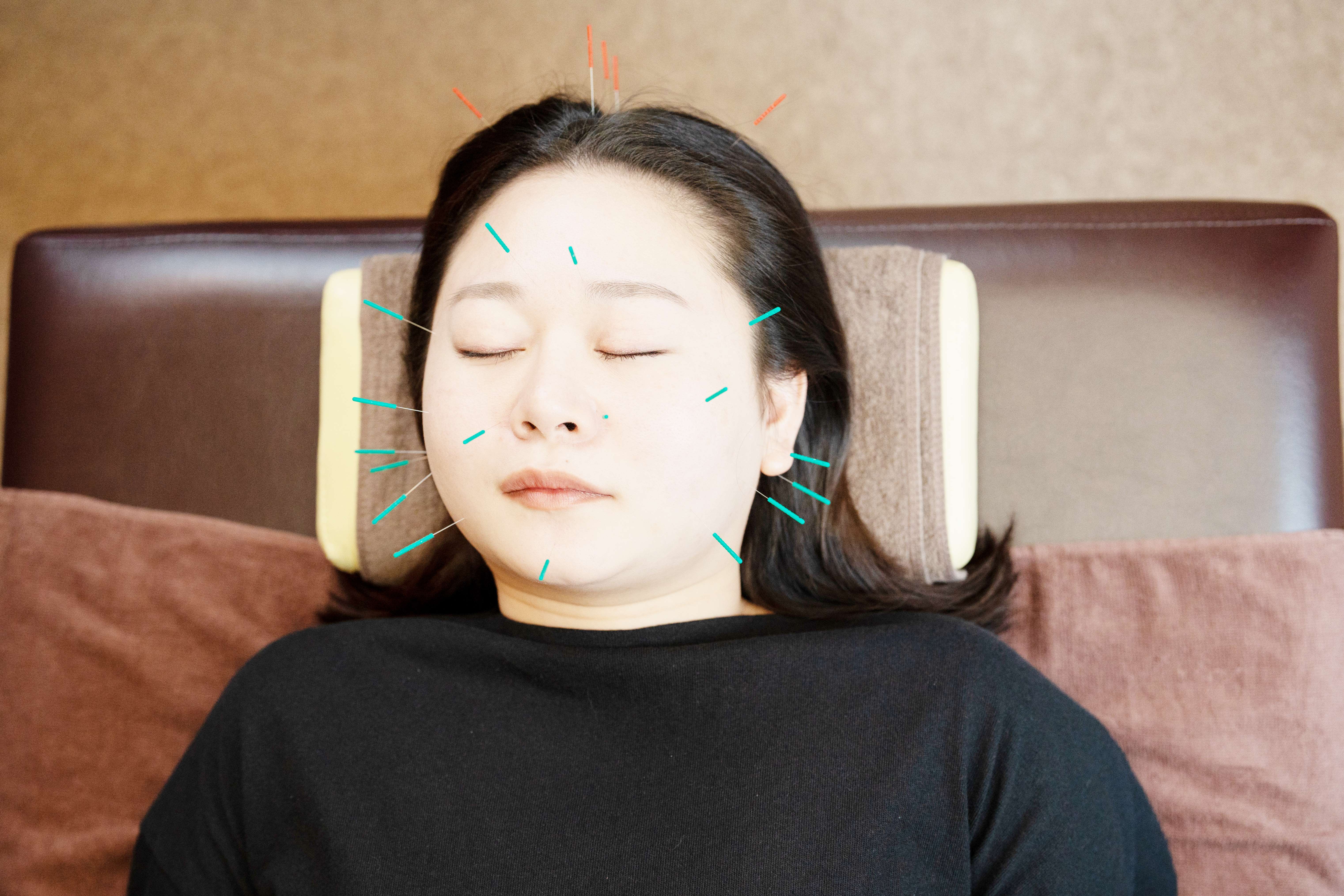 ルヌーラ　total spa 美顔鍼+肩リンパのメニュー画像